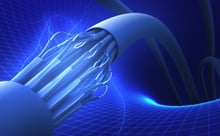 CR85 Technology Prevents False Alerts